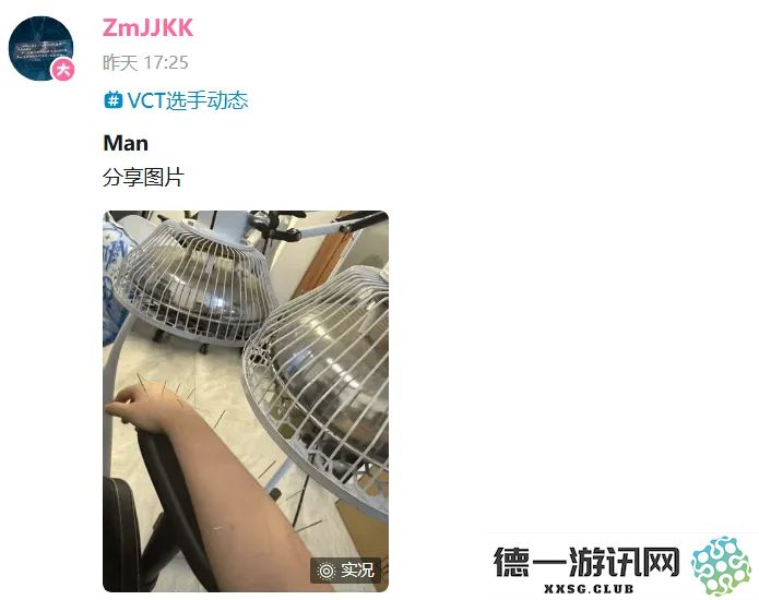 加油啊！ZmjjKK选手晒出恢复之路中的针灸理疗实拍照片